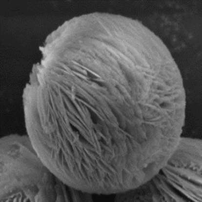 Hairy Sphere.png